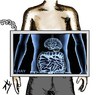 Cartoon: brain x ray (small) by yaserabohamed tagged ray