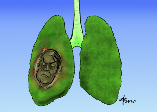 Cartoon: Grüne-Lungenkrebs (medium) by Paolo Calleri tagged welt,brasilien,regenwald,amazonas,praesident,jair,bolsonaro,vernichtung,flaechte,landwirtschaft,wirtschaft,umwelt,umweltschutz,klima,klimawandel,co2,lunge,gruene,rechtspopulismus,zukunft,karikatur,cartoon,paolo,calleri,welt,brasilien,regenwald,amazonas,praesident,jair,bolsonaro,vernichtung,flaechte,landwirtschaft,wirtschaft,umwelt,umweltschutz,klima,klimawandel,co2,lunge,gruene,rechtspopulismus,zukunft,karikatur,cartoon,paolo,calleri