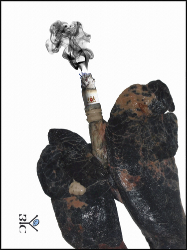 Cartoon: Smoking is a health (medium) by Zoran Spasojevic tagged serbia,kragujevac,emailart,paske,spasojevic,zoran,health,smoking,graphics,collage,digital