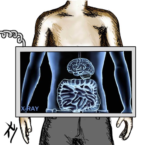Cartoon: brain x ray (medium) by yaserabohamed tagged ray