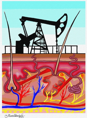 Cartoon: Dermatology or Petrol (medium) by halisdokgoz tagged dermatology,or,petrol